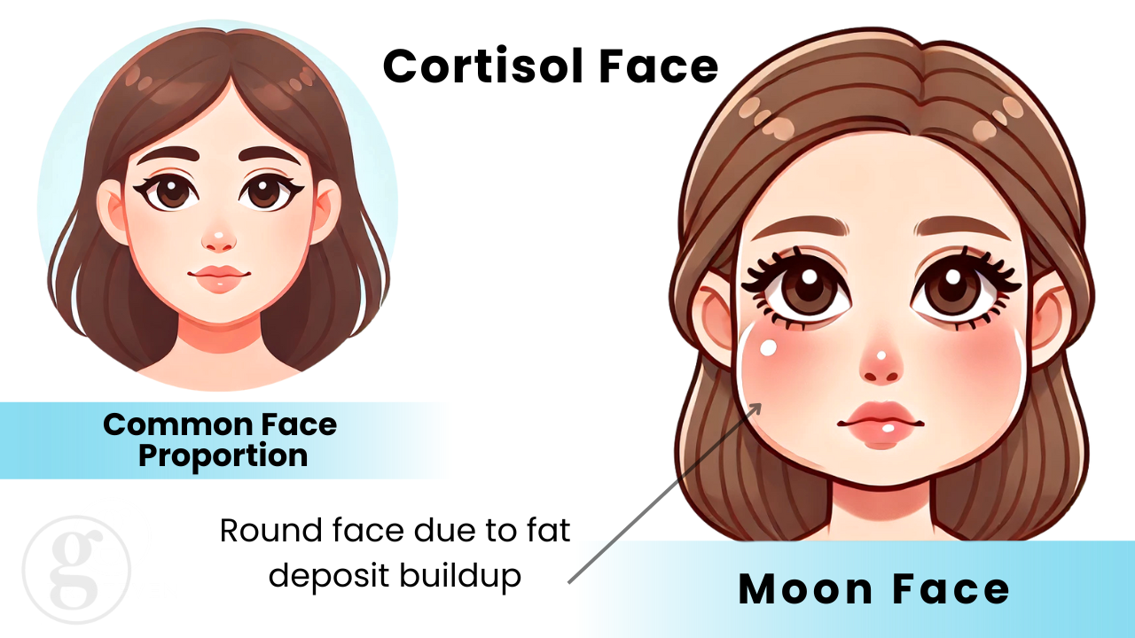 Cortisol Face: Understanding the Link Between Stress, Insulin Resistance, and Your Health